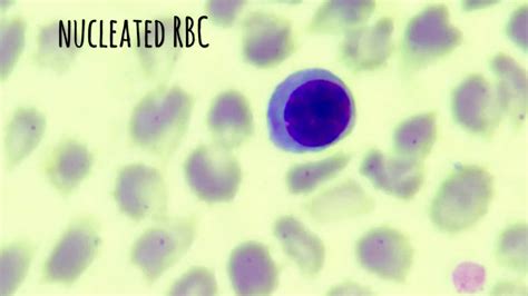 Nucleated RBC in blood smear - YouTube