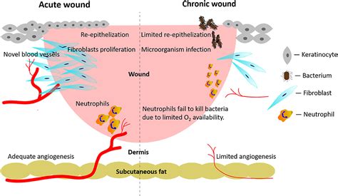 verbunden Verzweiflung kubisch mechanism of wound healing Neue Bedeutung Trend Durchdringen