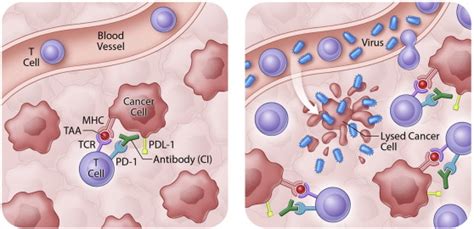 Oncolytic Viruses: Therapeutics With an Identity Crisis - eBioMedicine