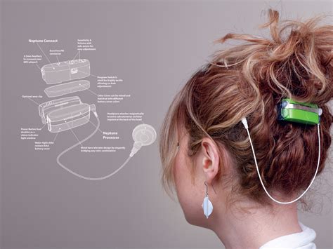 DesignApplause | Advanced bionics neptune waterproof cochlea implant ...