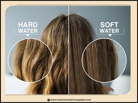 Hard Water Vs Soft Water Hair Loss at Robert Eberhardt blog