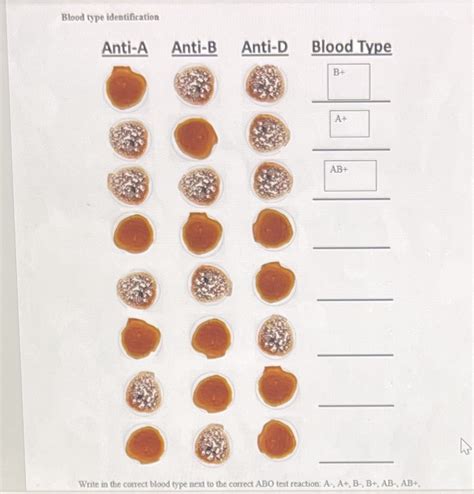 [Solved] Blood type identification Anti-A Anti-B Anti-D Blood Type B+ A+ AB+... | Course Hero