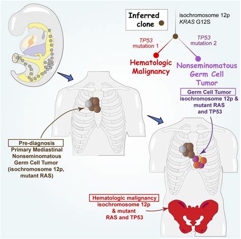 JCI - Germ cell tumors and associated hematologic malignancies evolve ...