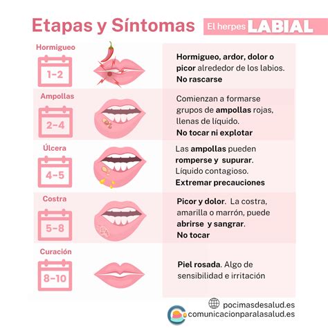 Herpes labial: sintomas, tratamiento y prevencion - Pocimas de salud