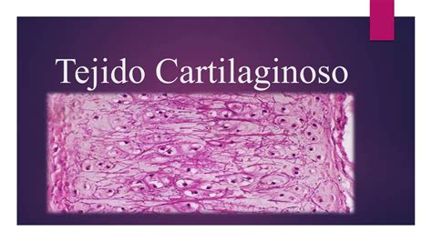 TEJIDO CARTILAGINOSO- HISTOLOGÍA (Explicación rápida) - YouTube