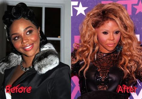 Lil Kim Plastic Surgery: The ugly truth? - Plastic Surgery Mistakes