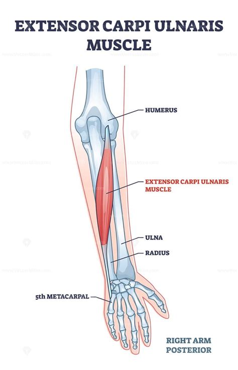 Extensor carpi ulnaris muscle with arm and hand wrist bones outline diagram – VectorMine