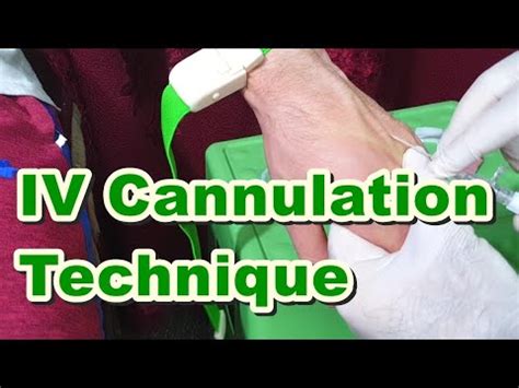 How to Insert IV Cannula | IV Cannulation Technique | Branula | Intravenous Catheter - YouTube