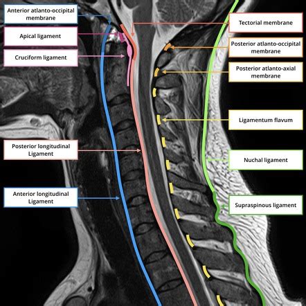 Cervical spine ligaments | Radiology Reference Article | Radiopaedia.org