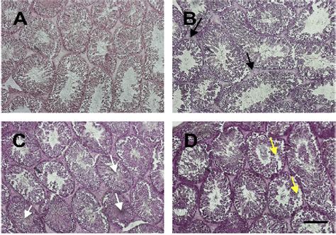 The histology of testis stained by HE staining in control (A) and ...