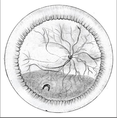 The best free Retinal drawing images. Download from 18 free drawings of Retinal at GetDrawings