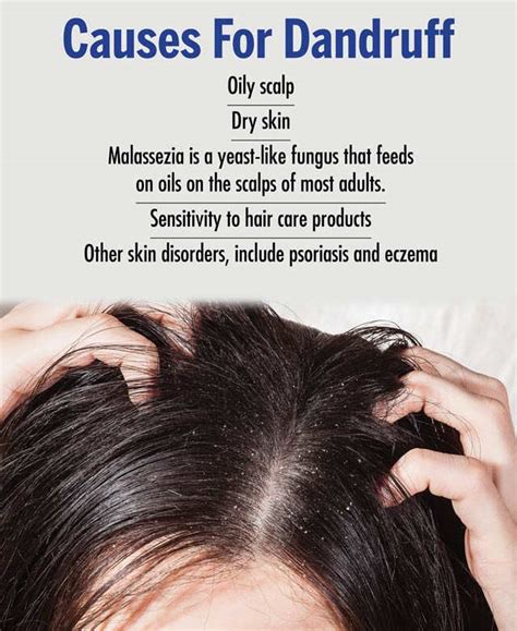 Reasons For Dandruff: Symptoms And Remedies To Get Rid Of It | Femina.in