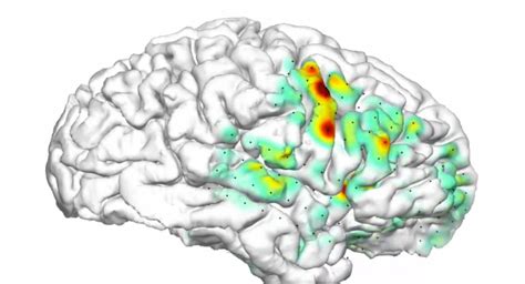 3-D ‘Heat Map’ Animation Shows How Seizures Spread in the Brains of ...