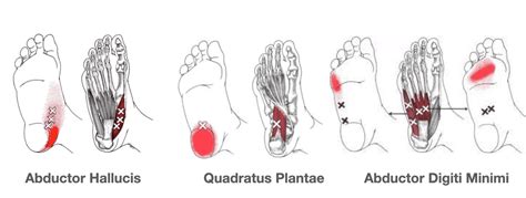 Self-Massage Techniques for Trigger Points in Your Feet