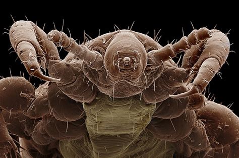 Magnified insect | Aaaaaaarrrrggggghhhhhh!!! | Pinterest