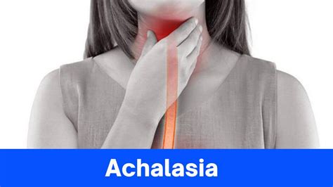 Achalasia: Causes – Symptoms And Treatment [Complete Explanation] » 2024