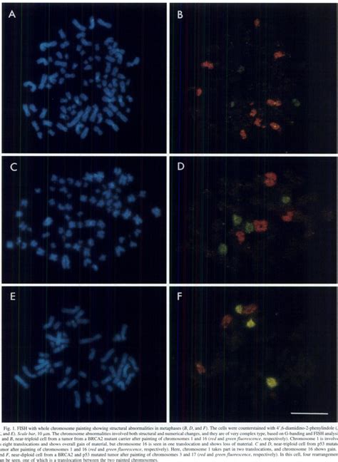 FISH with whole chromosome painting showing structural abnormalities in ...