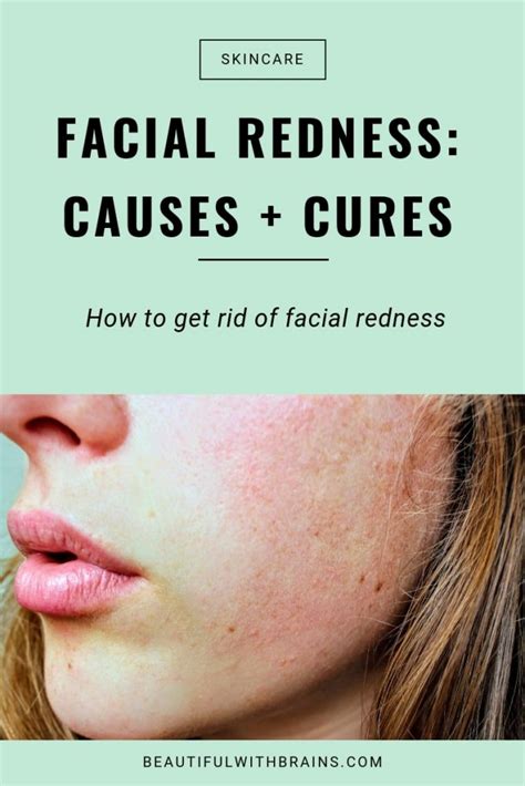 Facial Redness: Causes And Cures – Beautiful With Brains