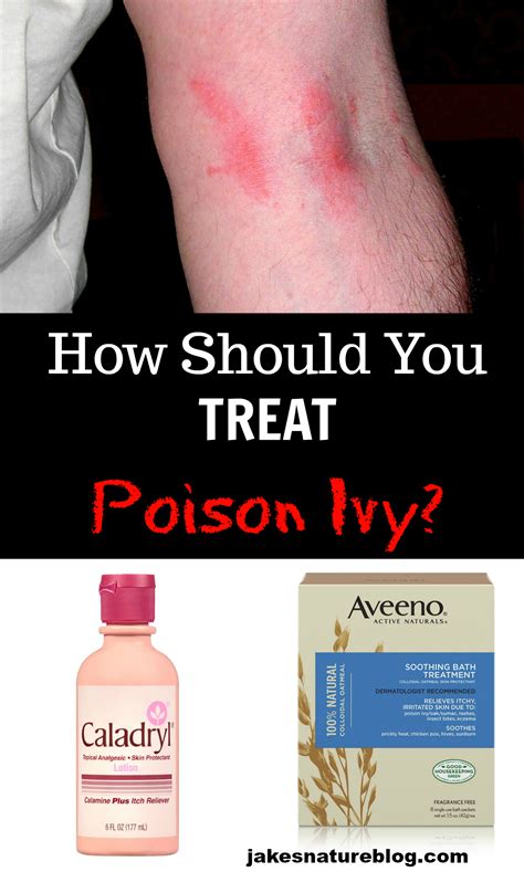 Poison Ivy Treatment - What Should You Do? - Jake's Nature Blog