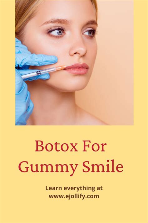 Botox For Gummy Smile • The Complete Guide | Botox, Gummy smile, Botox injections