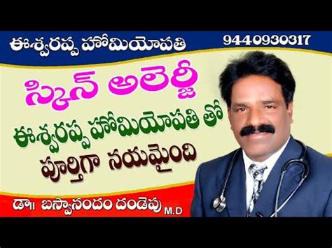 Skin allergy cured with Eshwarappa homeopathy Contact 9440930317 ,Hyderabad - YouTube