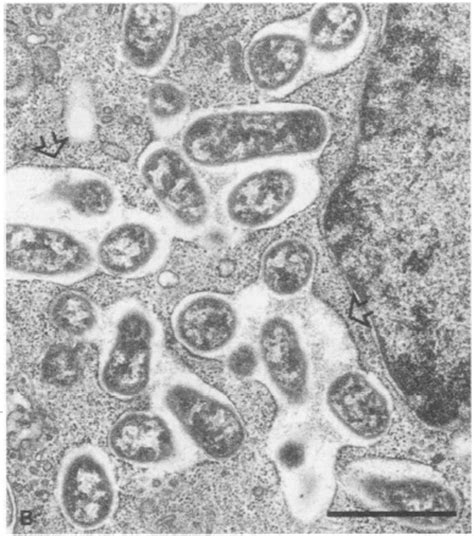 Brucella - microbewiki