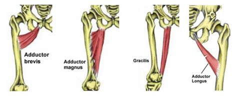 Hip Groin Muscle Anatomy Groin Inflammation Adductor Tendinopathy | Images and Photos finder