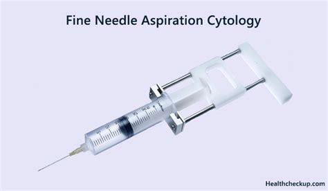 Fine Needle Aspiration Cytology: Preparation, Procedure, Results