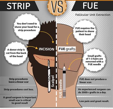 Patient Infographic: Hair Restoration Timeline | Dr.Robert Jones