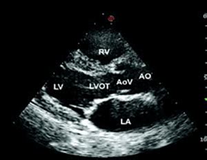 2D Echocardiogram In Beverly Hills, Los Angeles - My Concierge MD