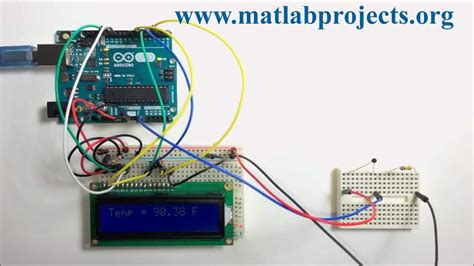 Biomedical Mini Projects - Matlab Projects | Matlab Project | Best IEEE Matlab Projects