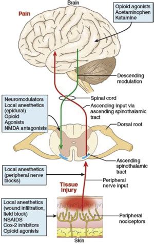 Multimodal Analgesia in Foot and Ankle Surgery | Musculoskeletal Key