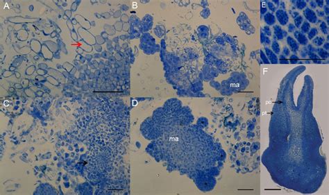 Protein staining with Coomassie brilliant blue R-250 (CBB) in... | Download Scientific Diagram