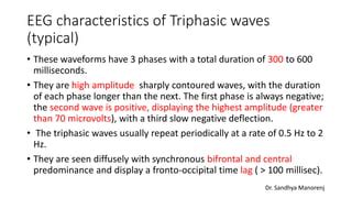 Triphasic waves in EEG | PPT