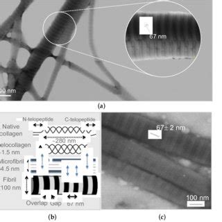 Collagen fibrils scanning transmission electron microscopy (STEM)... | Download Scientific Diagram