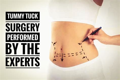 Know, Abdominoplasty surgery and how it performed by surgeon?