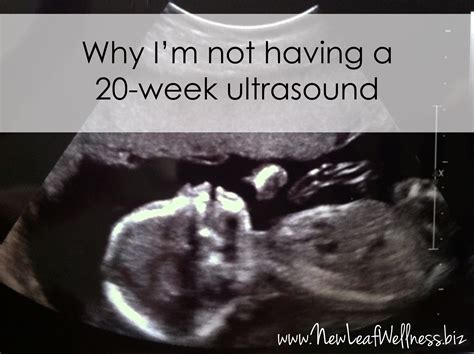 Why I’m skipping the 20-week ultrasound | The Family Freezer