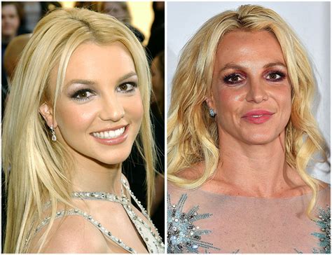 Britney Spears Plastic Surgery — An Expert Breaks Down Her Look