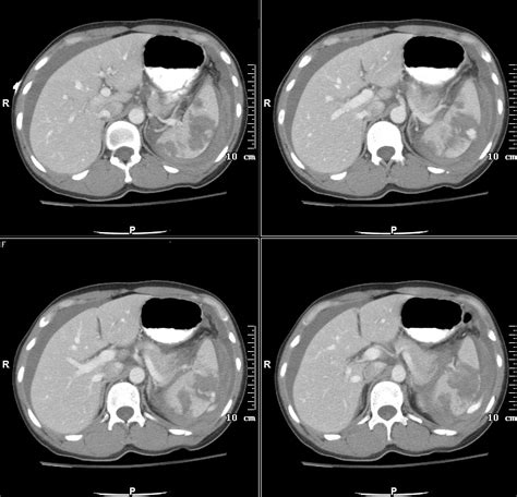 Gastrointestinal Radiology