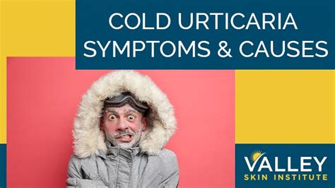 Cold Urticaria Symptoms and Causes | Valley Skin Institute