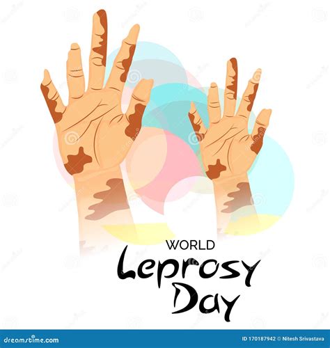 World Leprosy Day stock illustration. Illustration of awareness - 170187942