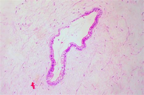 Omphalomesenteric Duct