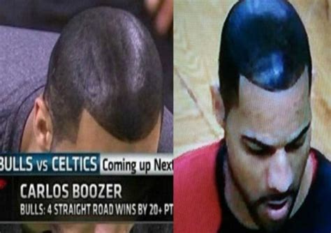 Lebron James Hairline Memes