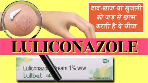 Luliconazole cream | Luliconazole cream 1 w/w uses in hindi | Luliconazole cream 1 w/w | - YouTube