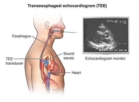 Echocardiogram - Children's Health Orange County