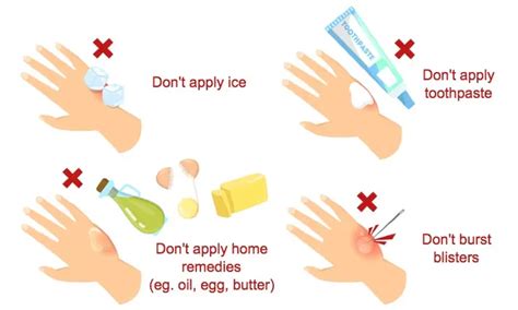 Preventing And Treating Burns At Home - Ask The Nurse Expert
