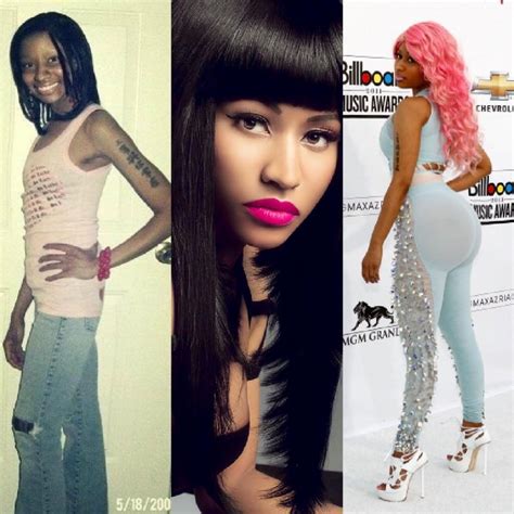 NICKI MINAJ BEFORE AND AFTER PLASTIC SURGERY | TERRY'S BLOG