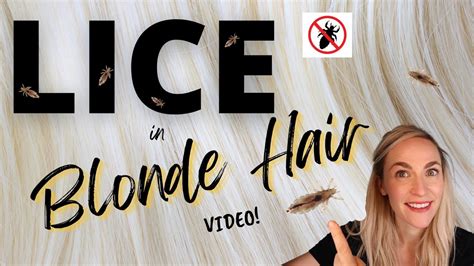 Lice in Blonde Hair - YouTube