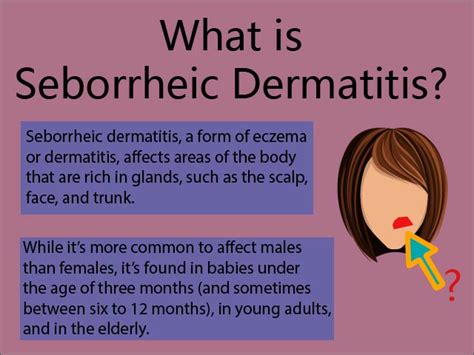 What's seborrheic dermatitis? - Battle eczema - Holistic Way