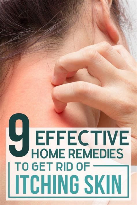 9 Effective Home Remedies To Get Rid Of Itching Skin | Itching skin, Hair skin nails, Skin